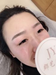 -郡艺医疗美容·微整·眼鼻吸脂