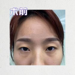 -素美医疗美容·西南眼鼻整形·修复基地