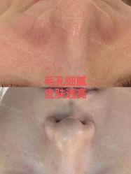 -LUNA皮相美·骨相美高级美感