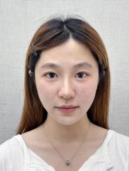 -深圳艺星医疗美容医院