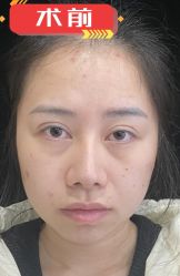 -素美医疗美容·西南眼鼻整形·修复基地