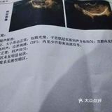 清宫手术后恢复心得