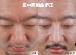 -北京米扬丽格医疗美容·联合丽格鼻整形中心