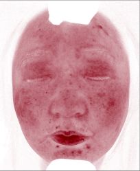 体验后-韩国淼美颜皮肤管理官方直营店