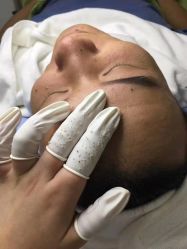 -苗颜坊专业祛痘全国连锁机构