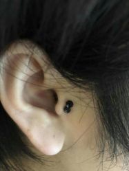 -肥三针腧穴瘦身馆