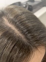 -熙朵美学植发连锁