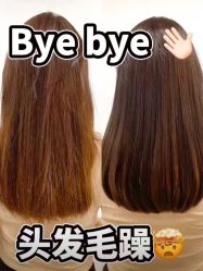 -菩叶脱发白发中心