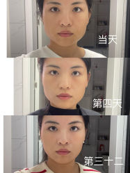 -成都西区医院整形美容