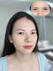 点击看大图 -张小野·专业半永久纹眉