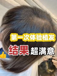-雍禾植发