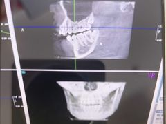 -土豆口腔(凤凰北总店)