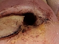 -新甲连锁灰指甲·甲沟炎·鸡眼(黑龙江路店)