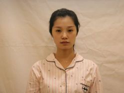 点击看大图 体验前-烟台曙光医疗美容医院
