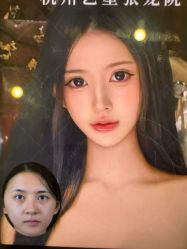 -Yestar杭州艺星医疗美容医院