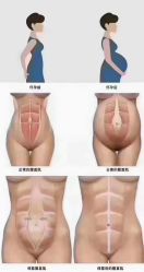 -安院长·产后恢复·徒手骨盆(先天下店)