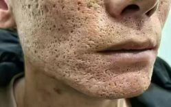 -禾壹净·素颜美问题肌肤修护中心