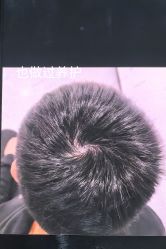 -北京雍禾植发医院