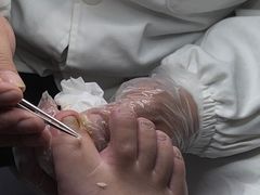 -新甲连锁灰指甲·甲沟炎·鸡眼(黑龙江路店)