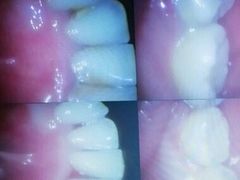 -深圳富茂格伦菲尔口腔门诊部(龙华清湖总院)