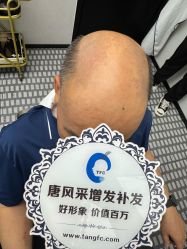 -唐风采假发补发定制