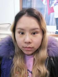-素美医疗美容·西南眼鼻整形·修复基地