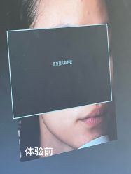 -BR光电保养