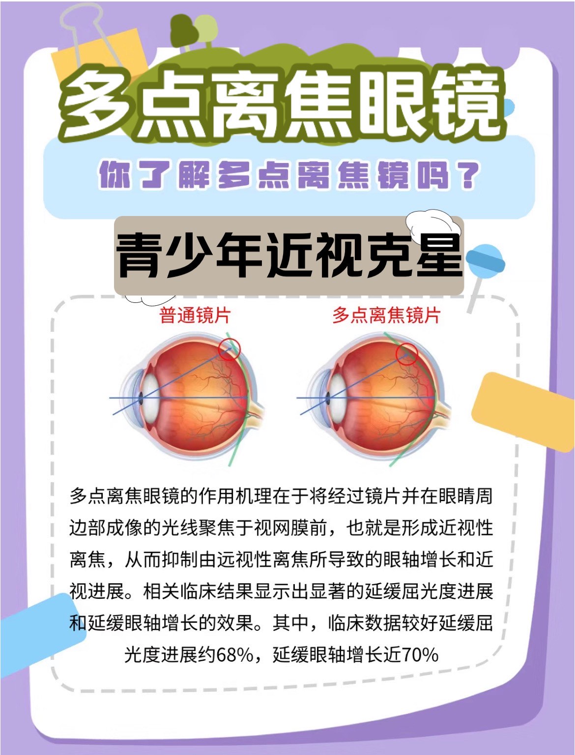配眼镜扩瞳的危害
