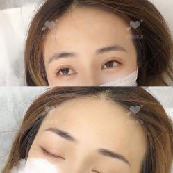 -西施无菌半永久纹绣眉眼影唇轻增发纹发际线