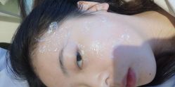 -美丽人生祛斑扁平疣汗管瘤中心