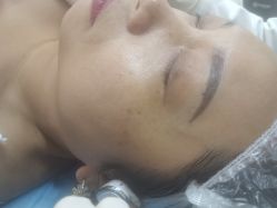 -长沙雅美医疗美容医院