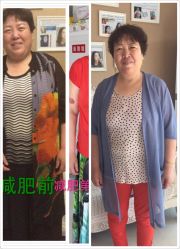 -苗方清颜专业祛痘