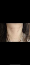 体验后-成都艾特他整形外科医院