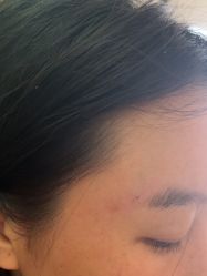 体验后-四川米兰柏羽医学美容医院