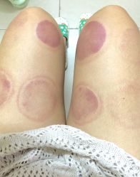 -绿竹·竹罐瘦身养生馆