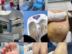 -Andrew指甲专科灰指甲·甲沟炎矫正·3D步态矫形鞋垫定制(上海法华镇路旗舰店)