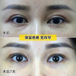 -丰联丽格医疗美容·联合丽格眼整形中心