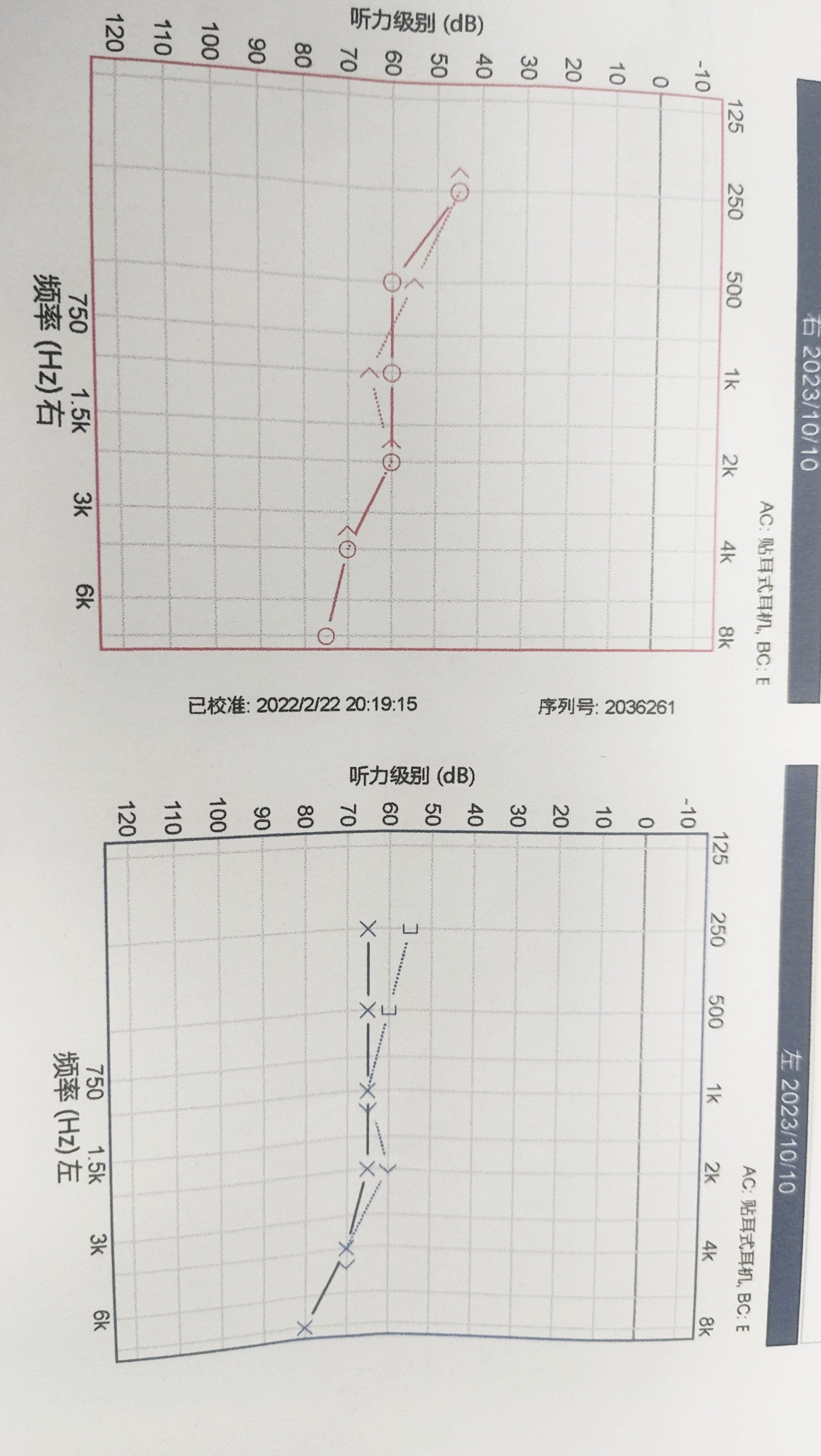 按照国家最新统一标准,听力损失程度分为以下几个等级: