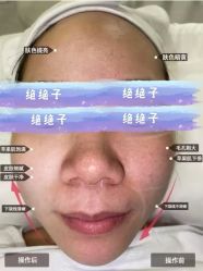 -SKIN79皮肤管理中心