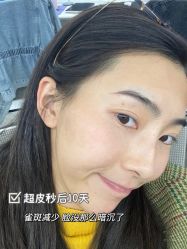 -Yestar宁波艺星整形医院