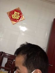 -大麦微针植发全国连锁