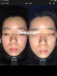 -Deeplus+韩国皮肤管理한국피부관리·C:Lab肌肤实验室