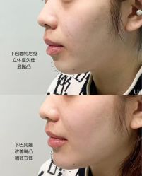 -克丽缇娜