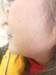 -长沙雅美医疗美容医院