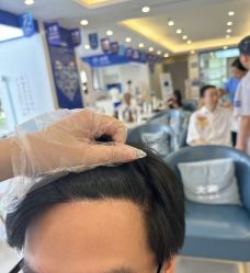 -大麦微针植发全国连锁