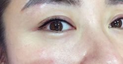 -依萱绮医疗美容