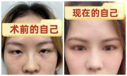 -素美医疗美容·西南眼鼻整形·修复基地