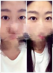 -YooMee优美智能科技美肤机构