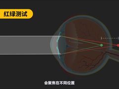 -东北大学附属辽宁爱尔眼科医院