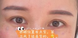 点击看大图 体验后-上海时光整形外科医院